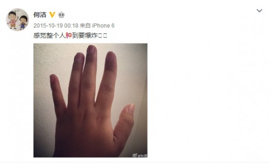 水肿来了真要命 范冰冰姚晨来给你支招了